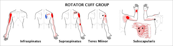 Trigger points and referred pain patterns for the teres major - Alila  Medical Images
